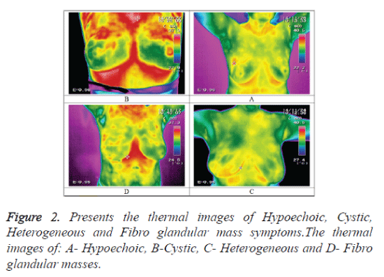 biomedres-thermal-images