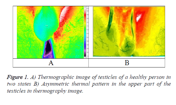 biomedres-thermography-image