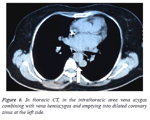 biomedres-thoracic-CT