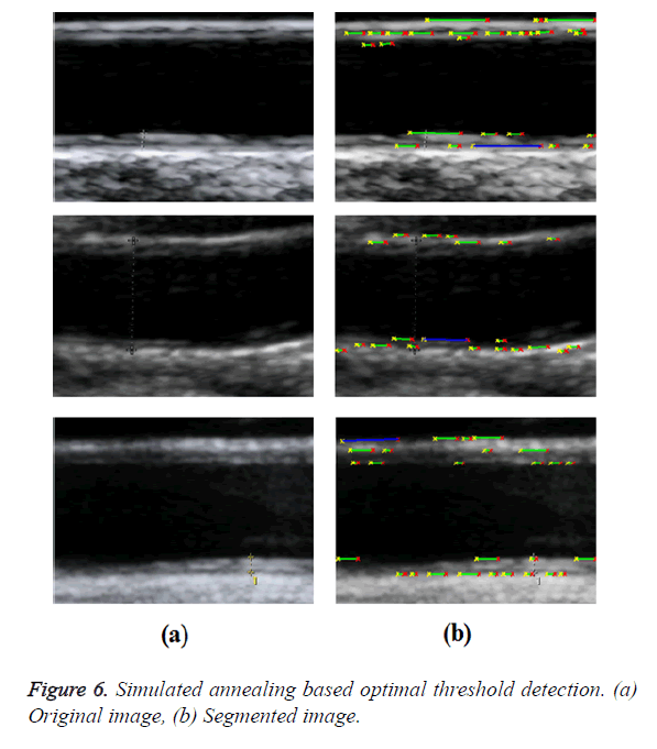 biomedres-threshold-detection