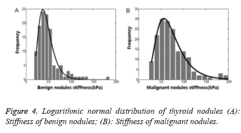 biomedres-thyroid-nodules