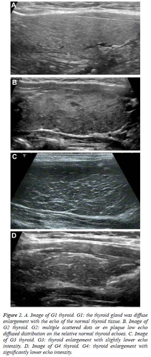 biomedres-thyroid-tissue