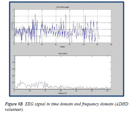 biomedres-time-domain-frequency