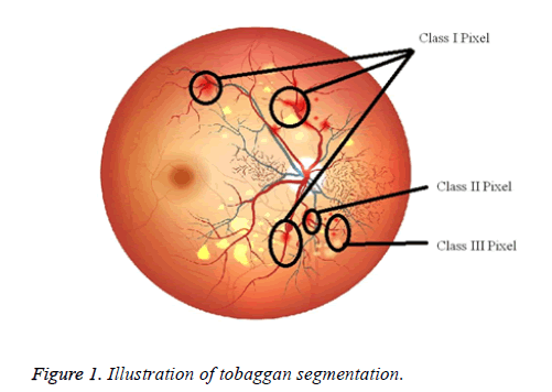 biomedres-tobaggan-segmentation