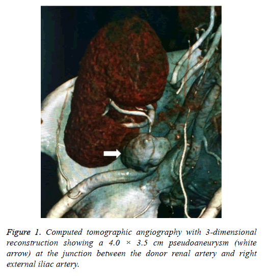 biomedres-tomographic-angiography