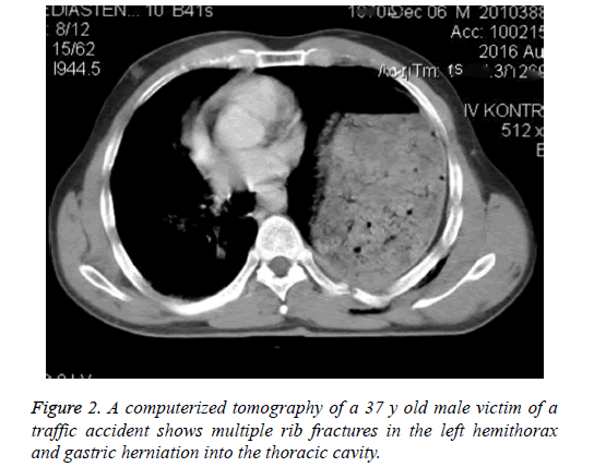 biomedres-tomography