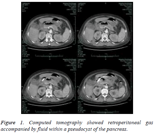 biomedres-tomography-fluid