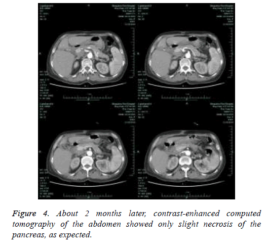 biomedres-tomography-fluid