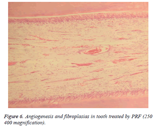 biomedres-tooth-inflammation