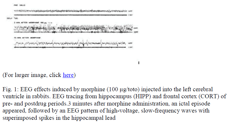 biomedres-tracing-hippocampus-frontal-cortex-postdrug