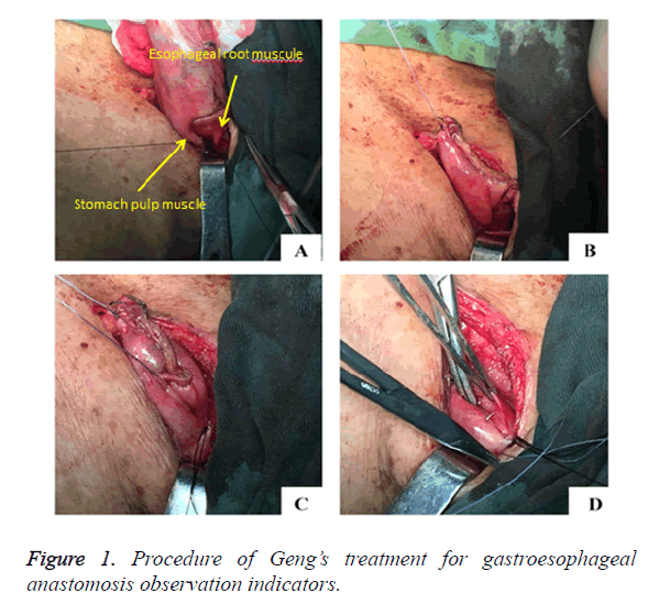 biomedres-treatment-gastroesophageal