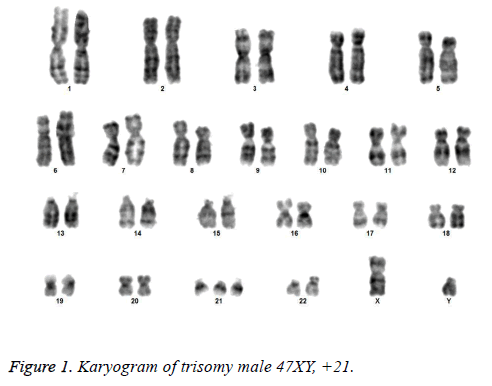 biomedres-trisomy-male