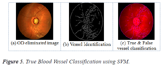 biomedres-true-blood-vessel