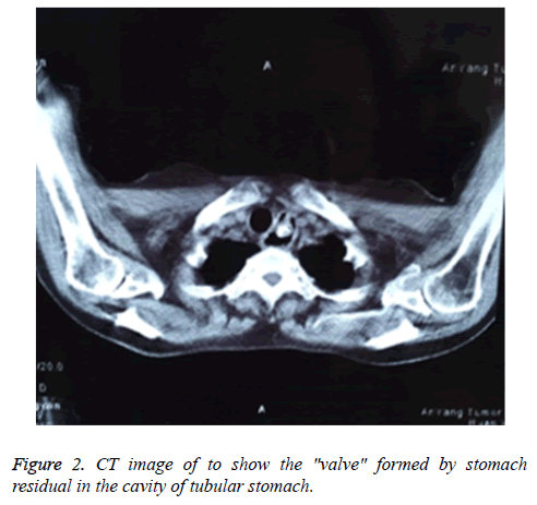 biomedres-tubular-stomach