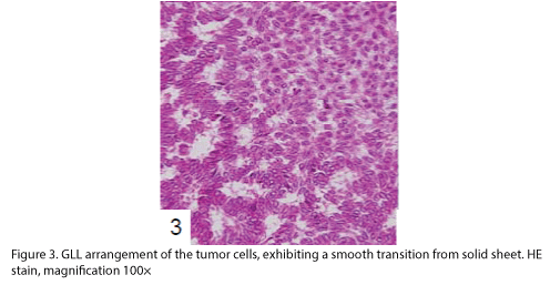 biomedres-tumor-cells