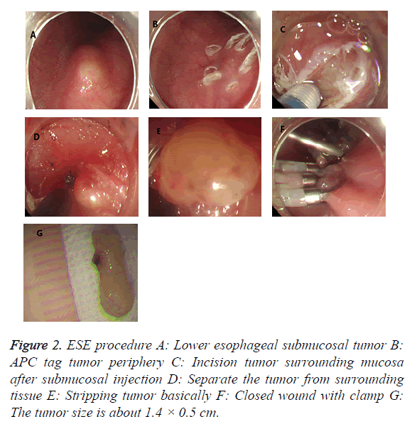 biomedres-tumor-periphery