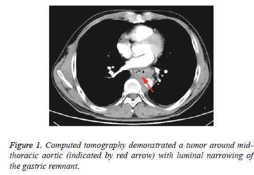 biomedres-tumor-tomography