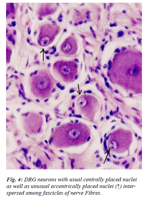 biomedres-unusual-eccentrically-placed-nuclei