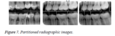 biomedres-upper-maxilla