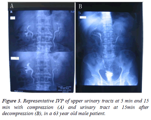 biomedres-upper-urinary