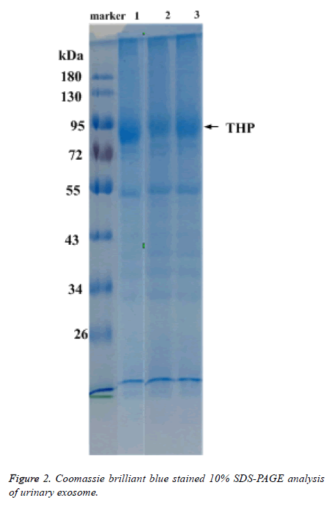 biomedres-urinary-exosome