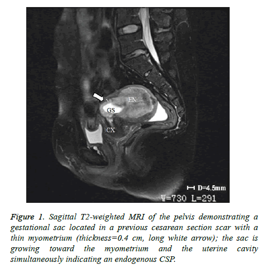 biomedres-uterin-cavity