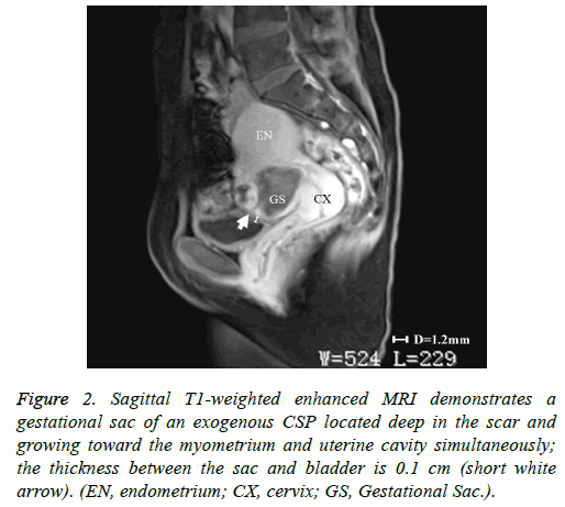 biomedres-uterin-cavity