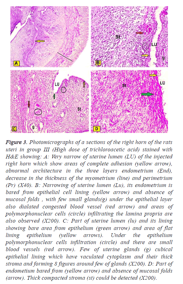 biomedres-uterine-lumen