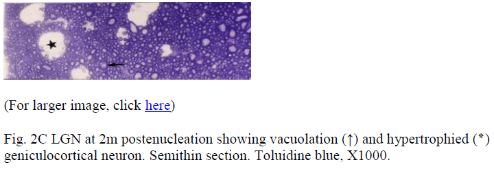 biomedres-vacuolation