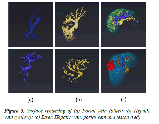 biomedres-vein-lesion