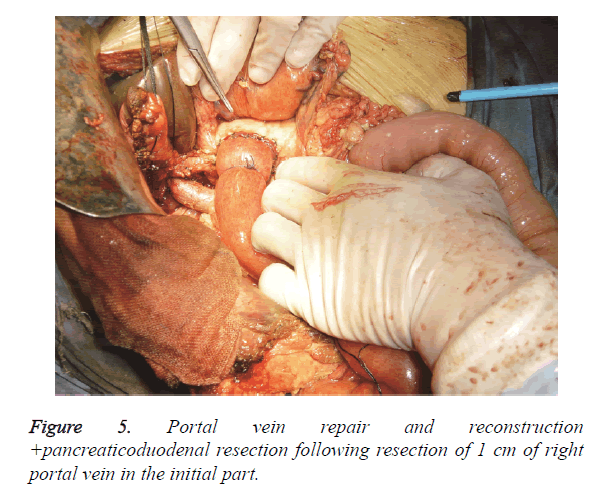 biomedres-vein-repair