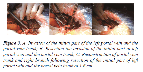 biomedres-vein-trunk