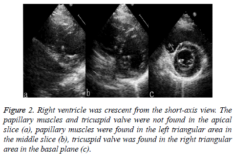 biomedres-ventricle-right