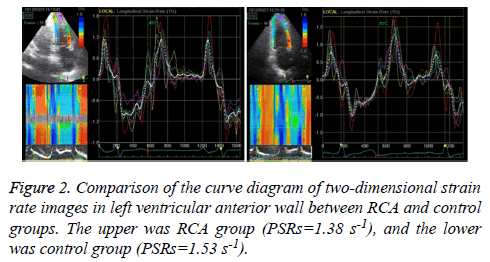 biomedres-ventricular-anterior