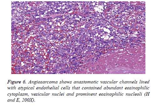 biomedres-vesicular-nuclei