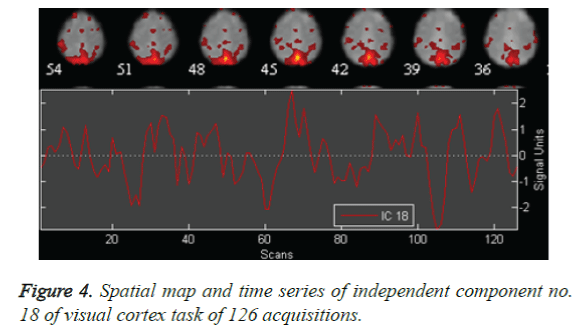 biomedres-visual-cortex-task