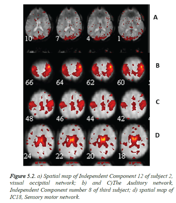 biomedres-visual-occipital-network