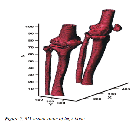 biomedres-visualization-bone