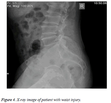 biomedres-waist-injury