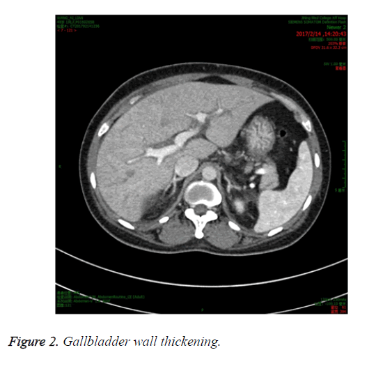 biomedres-wall-thickening