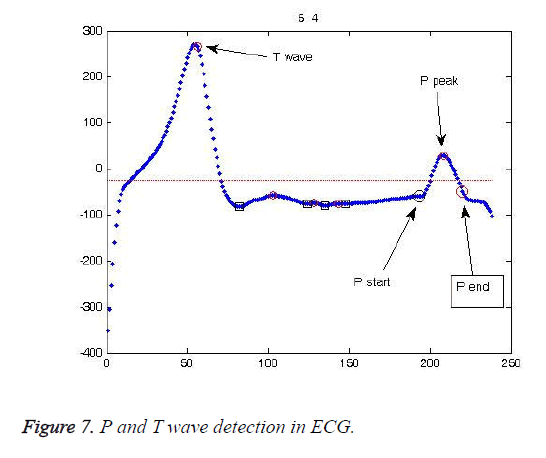 biomedres-wave-detection