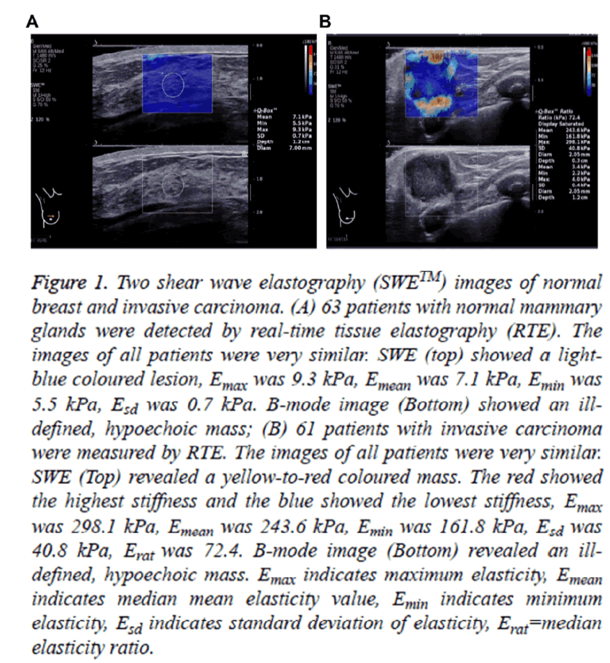 biomedres-wave-elastography