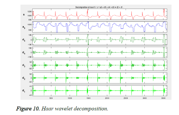 biomedres-wavelet-decomposition