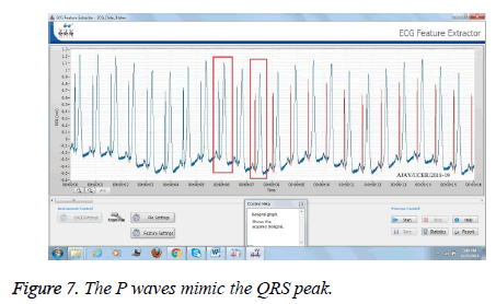 biomedres-waves-mimic