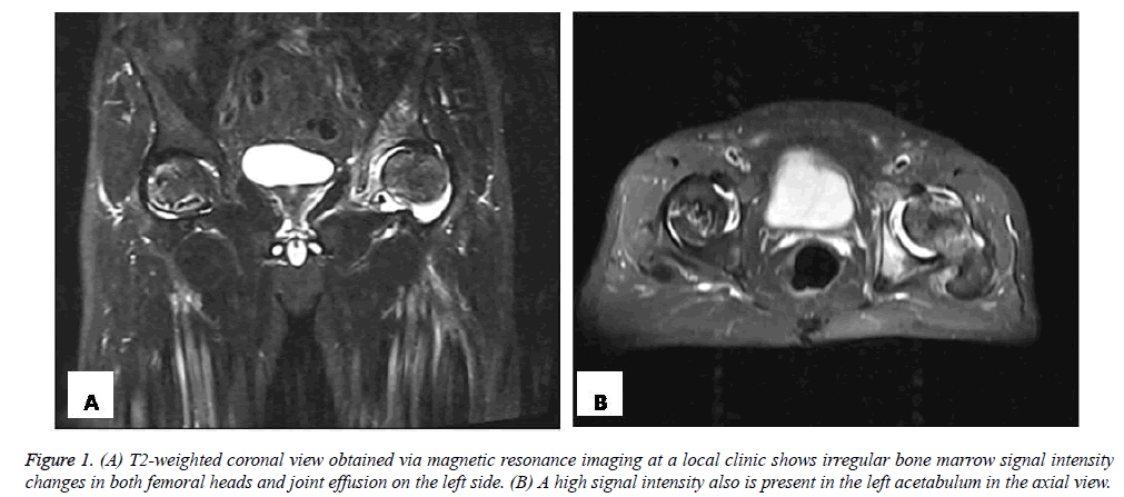 biomedres-weighted-coronal