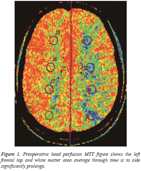 biomedres-white-matter